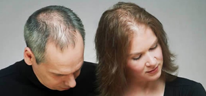 caduta dei capelli